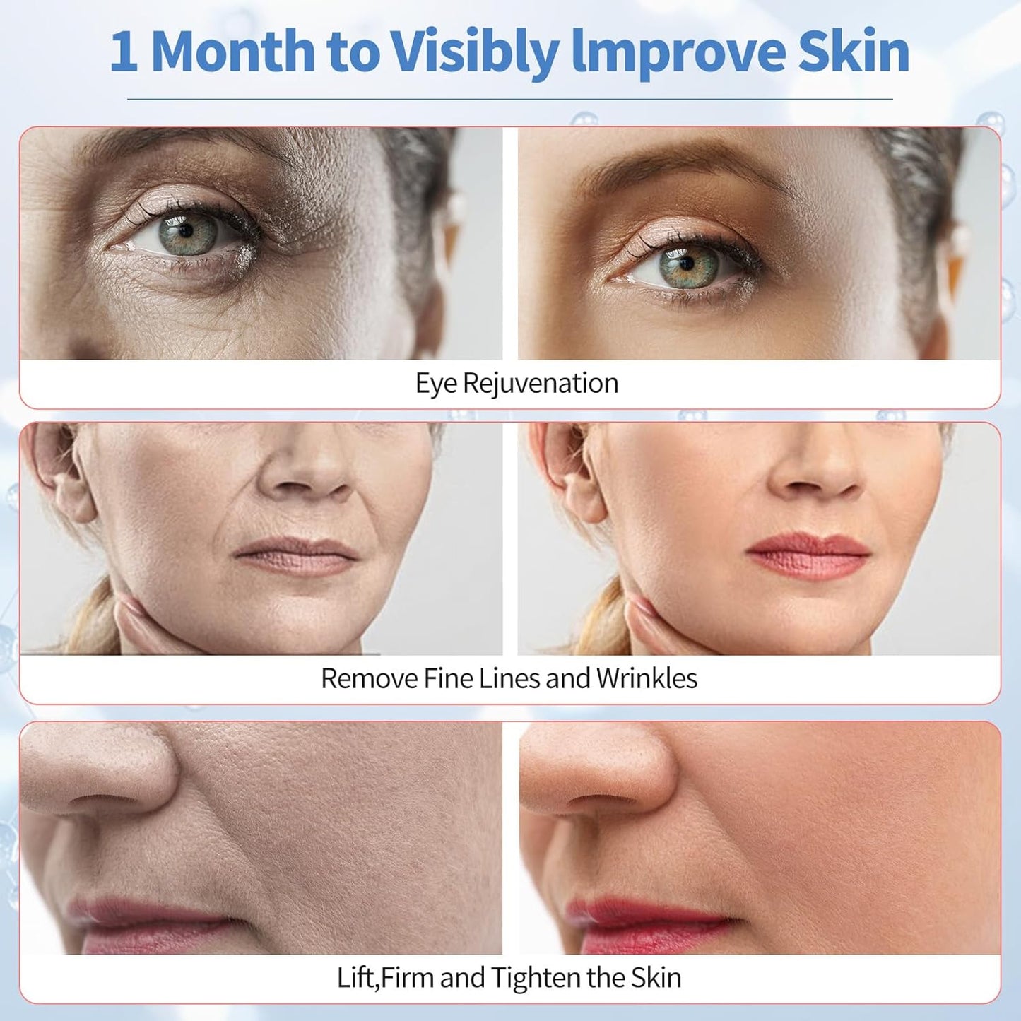 Toneé™ - 6-in-1 EMS Beauty Device
